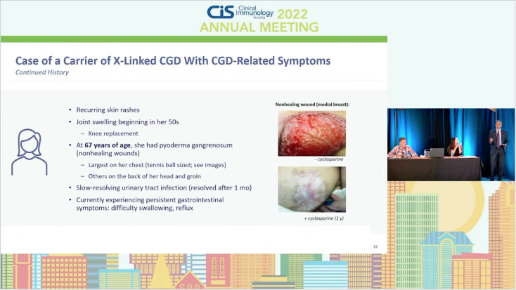 Case of a Carrier of X-Linked CGD with CGD-Related Symptoms video thumbnail